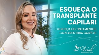 Esqueça o Transplante Capilar! | Conheça os Tratamentos Capilares para Calvície