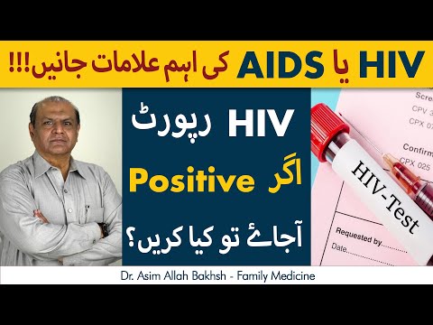 Early Signs Of HIV | HIV Ki Alamaat | HIV Positive Symptoms