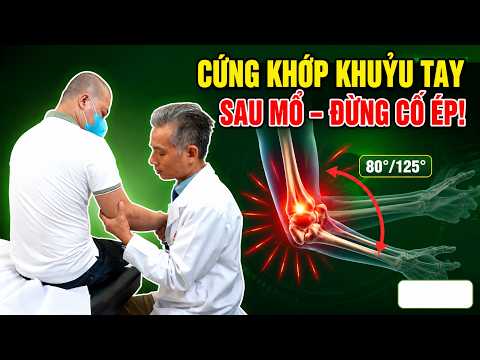Cứng Khớp Khuỷu Tay Sau Mổ: Càng Cố Ép Càng Khó Duỗi