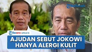 Ajudan Bantah Jokowi Kena Steven Johnson Syndrome, Sebut Hanya Alergi Kulit Pulang dari Vatikan