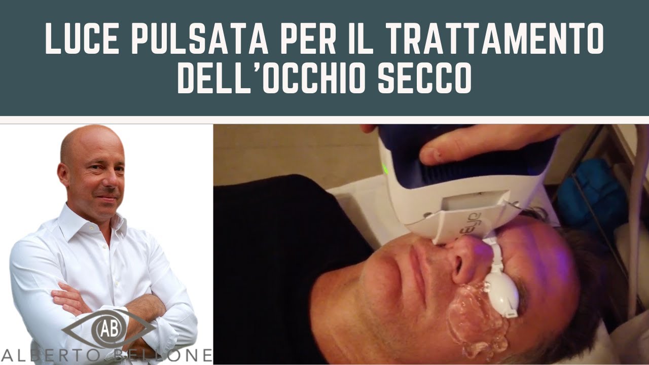 Luce pulsata per il trattamento dell'occhio secco