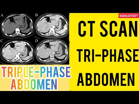 image-How long does a 3 phase CT scan take?