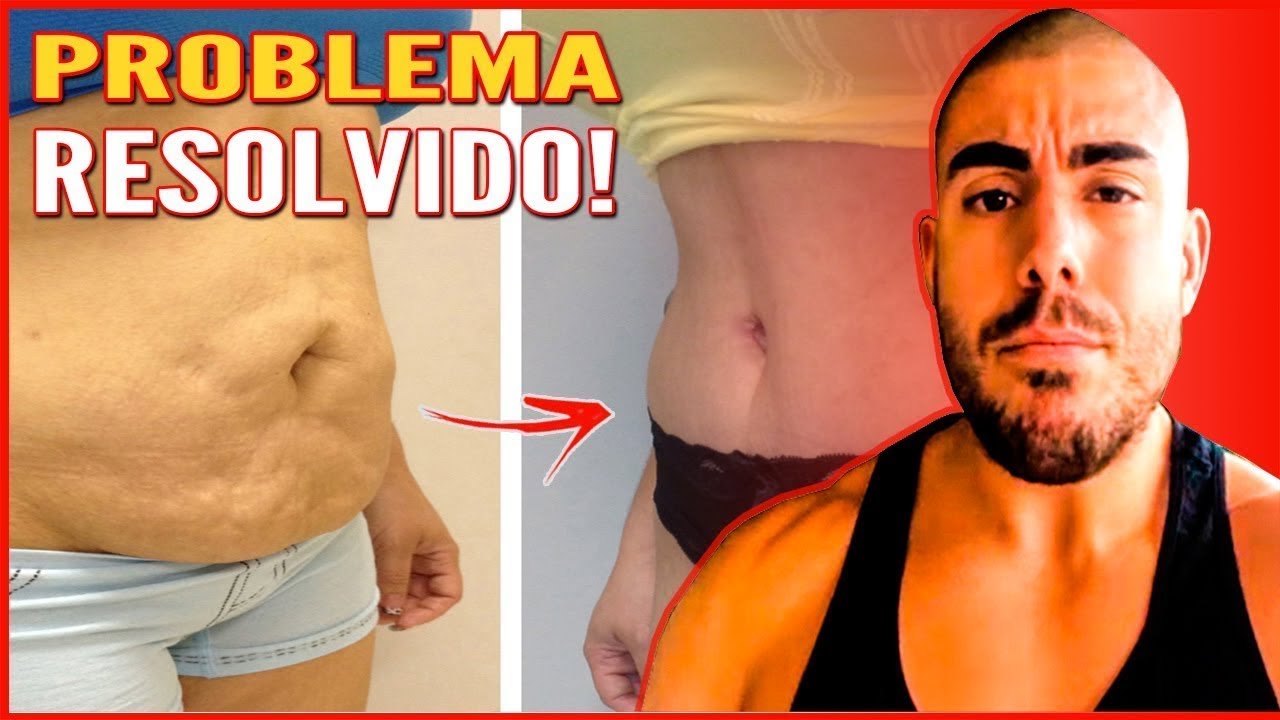 Como resolver flacidez na barriga