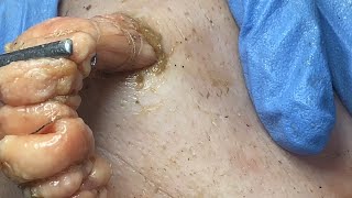 Download lagu π»ππ π©πππ ππππππ πͺππππππππ πΉπππππππ & πΊπππππππππ πππ π°ππππ π·ππππ #901173 mp3 Download lagu π»ππ π©πππ ππππππ πͺππππππππ πΉπππππππ & πΊπππππππππ πππ π°ππππ π·ππππ #901173 mp3