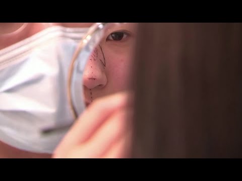 韓國戴口罩結束前急於整容。 (Rush for plastic surgery before mask-wearning ends in South Korea)
