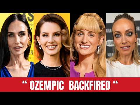 18 Celebrities Ozempic Face Transformations of 2026 That Backfired