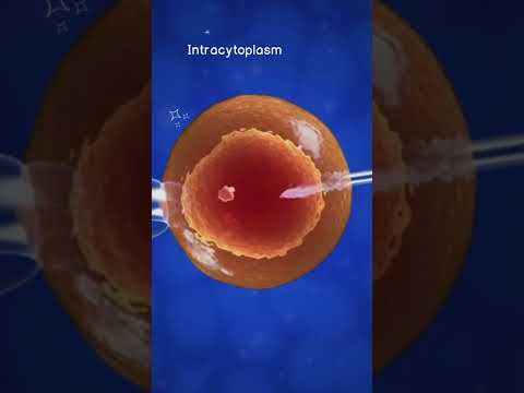 How Invitro Fertilization (IVF) works 😊 #shorts