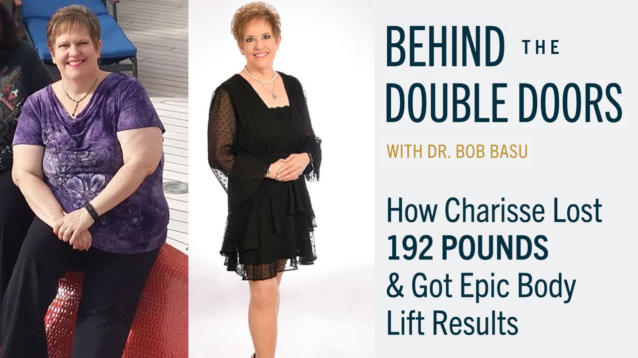 How Charisse Lost 192 Lbs & Got Epic Body Lift Results
