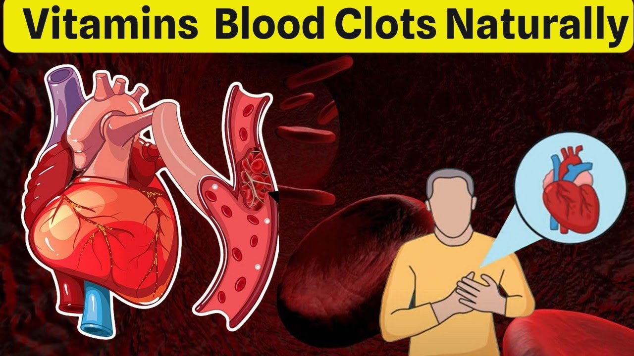 Potent Dietary vitamins to Naturally Dissolve Blood Clots - Unlocking the Vitality of Health 