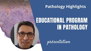 The @melanopath Project presentation ! Pathology Highlights