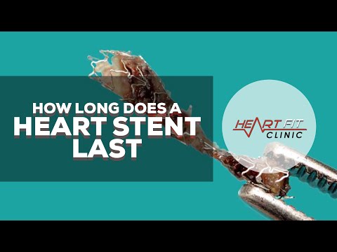 How long does a heart stent last
