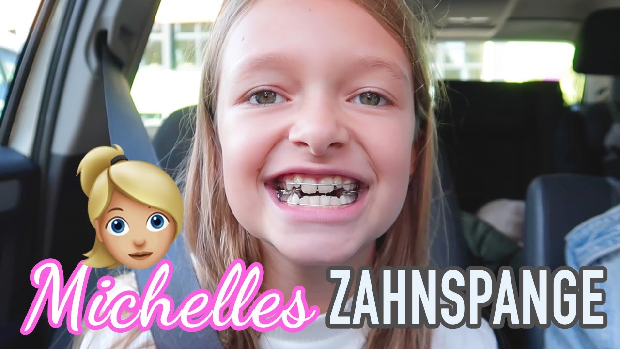 ZAHNSPANGE für Michelle | DIANA DIAMANTA