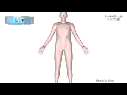 顕微鏡的大腸炎