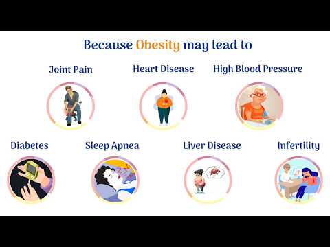 Bariatric Surgery Explained