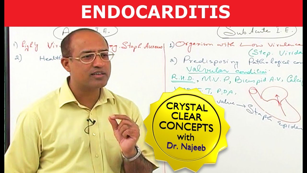 Endocarditis | Cardiac Pathology🫀 - YouTube