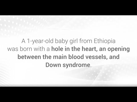 A Miracle of Healing and Hope: The Journey of Little Tyobista from Ethiopia