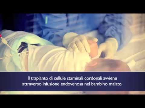 La faccia scarlatta fa i bagagli da posti Come cerchi scuri sotto occhi