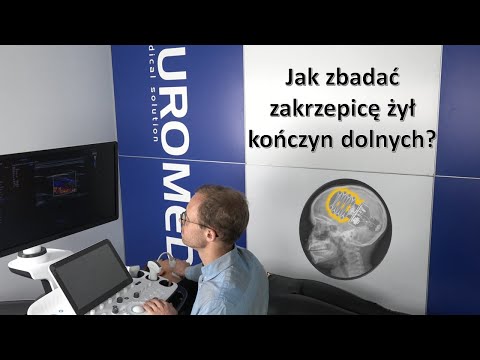 Zakrzepica żył kończyn dolnych - jak ocenić w USG.