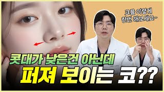 콧대가 낮은 건 아닌데, 퍼져 보인다면? 콧볼축소가 필요할 수도!?