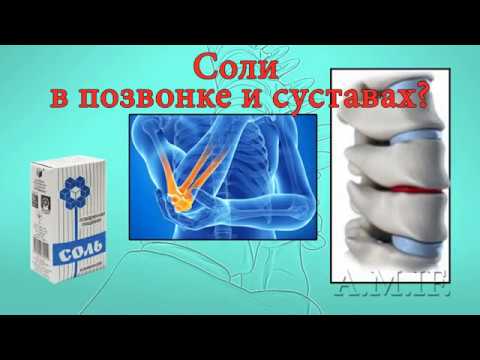 Какую мазь купить для шейного остеохондроза Что то болит по женски и отдает в поясницу
