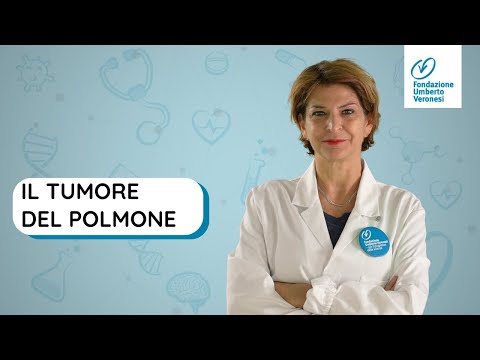 Lung cancer: symptoms, risk factors, treatments, and research