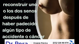 preview picture of video 'Dr. Victor E. Pera Gálvez  - Mamoplastía de Aumento - Cambio de Implantes Mamarios'