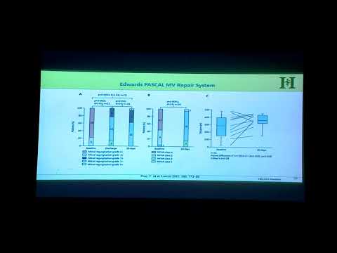 20190830_32_Beating heart mitral valve surgery-Echo perspectives_Dr Chirojit Mukherjee