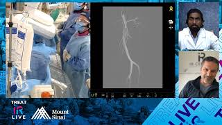 Genicular Artery Embolization GAE Knee OA