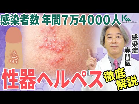 単純ヘルペスウイルス