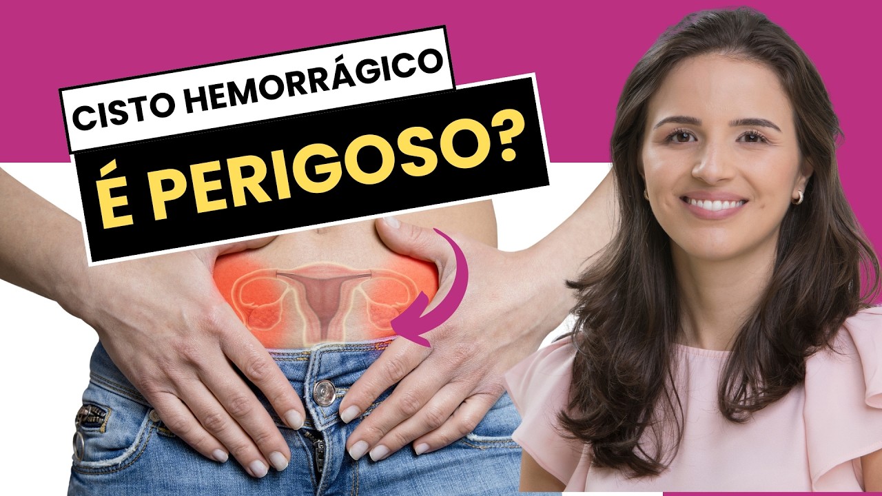 CISTO DE OVÁRIO HEMORRÁGICO: TIRE SUAS DÚVIDAS E SAIBA QUANDO SE PREOCUPAR!