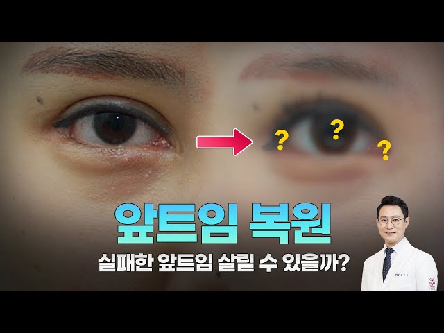라리성형외과 라리성형외과