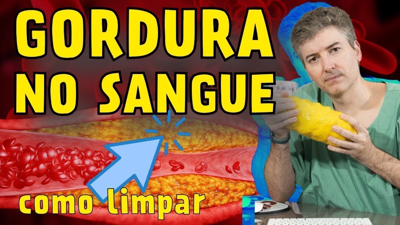 Gordura no Sangue: Como prevenir a formação de placa nas artérias