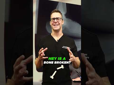 How To Treat Morton s Neuroma Foot Injection Research 2021