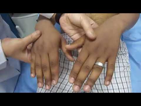 21- Thyroid Status Examination, Hand, Hair(Dr. Rajooj)