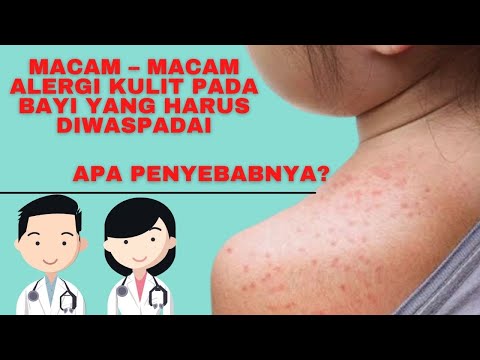 Ketahui Macam-Macam Alergi Kulit Pada Bayi yang Sering Terjadi