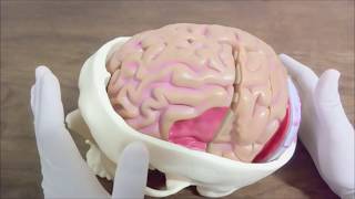 Principais Lesões cerebrais - Aula Completa