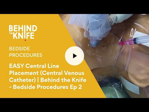 EASY Central Line Placement (Central Venous Catheter) | Behind the Knife - Bedside Procedures Ep 2
