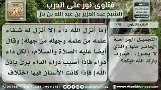 صورة 1870 - حكم إصلاح الأسنان المشوهة - نور على الدرب