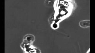 Neutrophil VS Promastigote