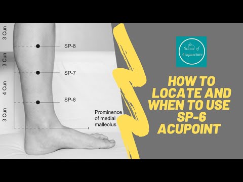 How to locate and to use acupuncture point SP-6 for musculoskeletal disorders