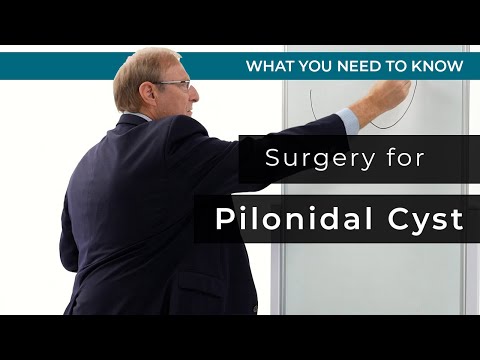 Surgery for Pilonidal Cyst