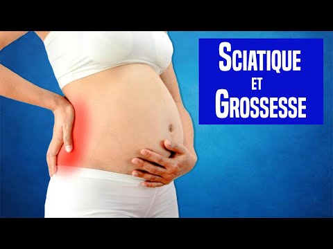 Sciatica and Pregnancy: Physiotherapy Exercises for Relief