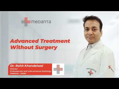 Advanced Treatment Without Surgery | Dr. Rohit Khandelwal | Medanta, Noida