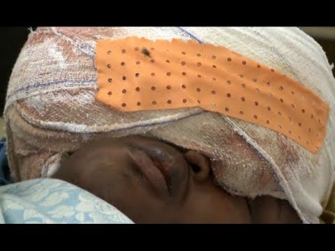 Santé: Témoignage d'un malade du cancer