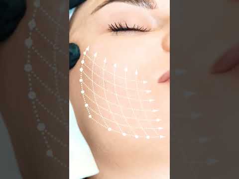 Cracked PDO Threads in #antiaging #dubai #viral #shorts #shortvideo #doctorlife #doctor — Spectronix YouTube Short