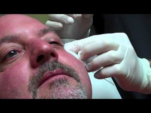 download lagu mp3 mp4 Botox Birmingham Al, download lagu Botox Birmingham Al gratis, unduh video klip Botox Birmingham Al