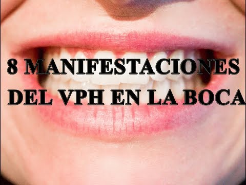 O que significa hpv nic 1