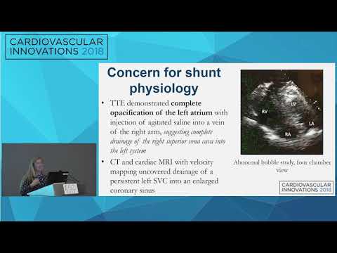 CVI2018 Session: First Reported Case of Duplicate SVC with Cross Drainage - Kiersten Frenchu