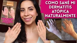 Como Sané mi Dermatitis Atópica sin Medicamentos y de Forma Natural!