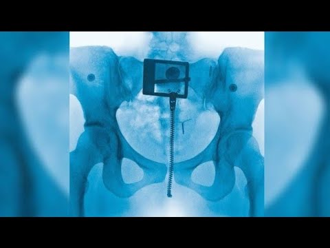 Lorde - Hammer (Official Audio)